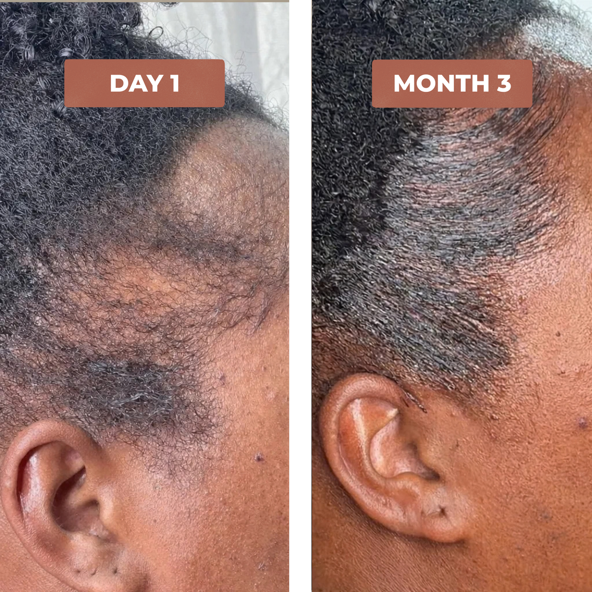 Aaliyah F. before and after results