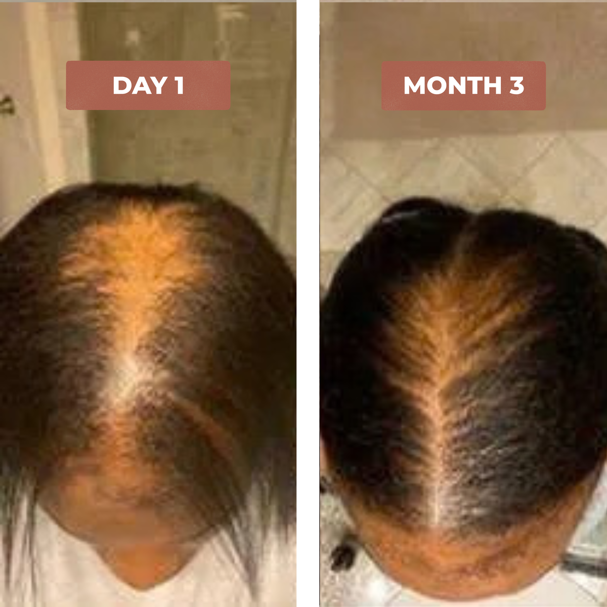 Monique B. before and after results