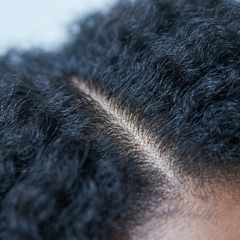 Scalp Health