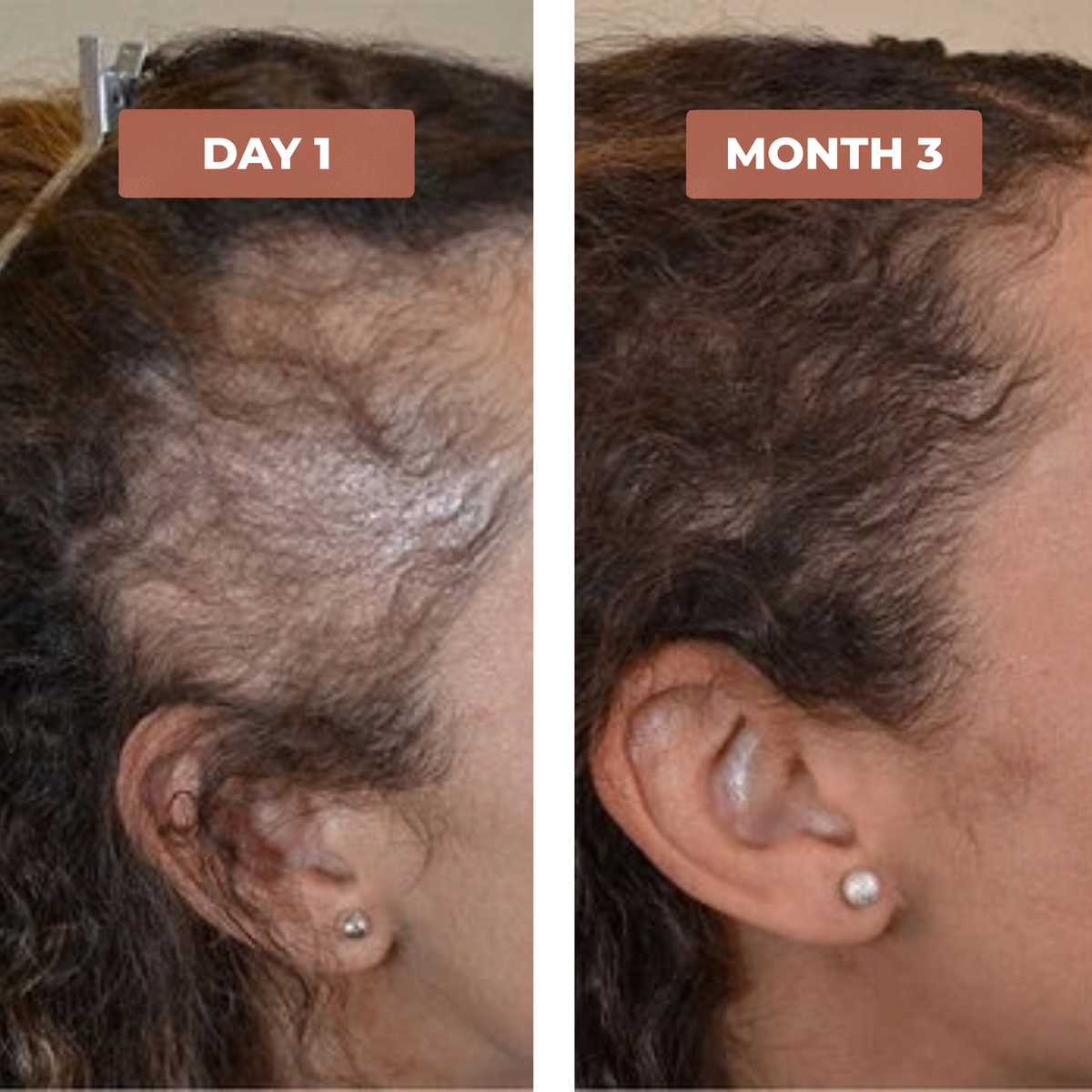 Destiny B. before and after results